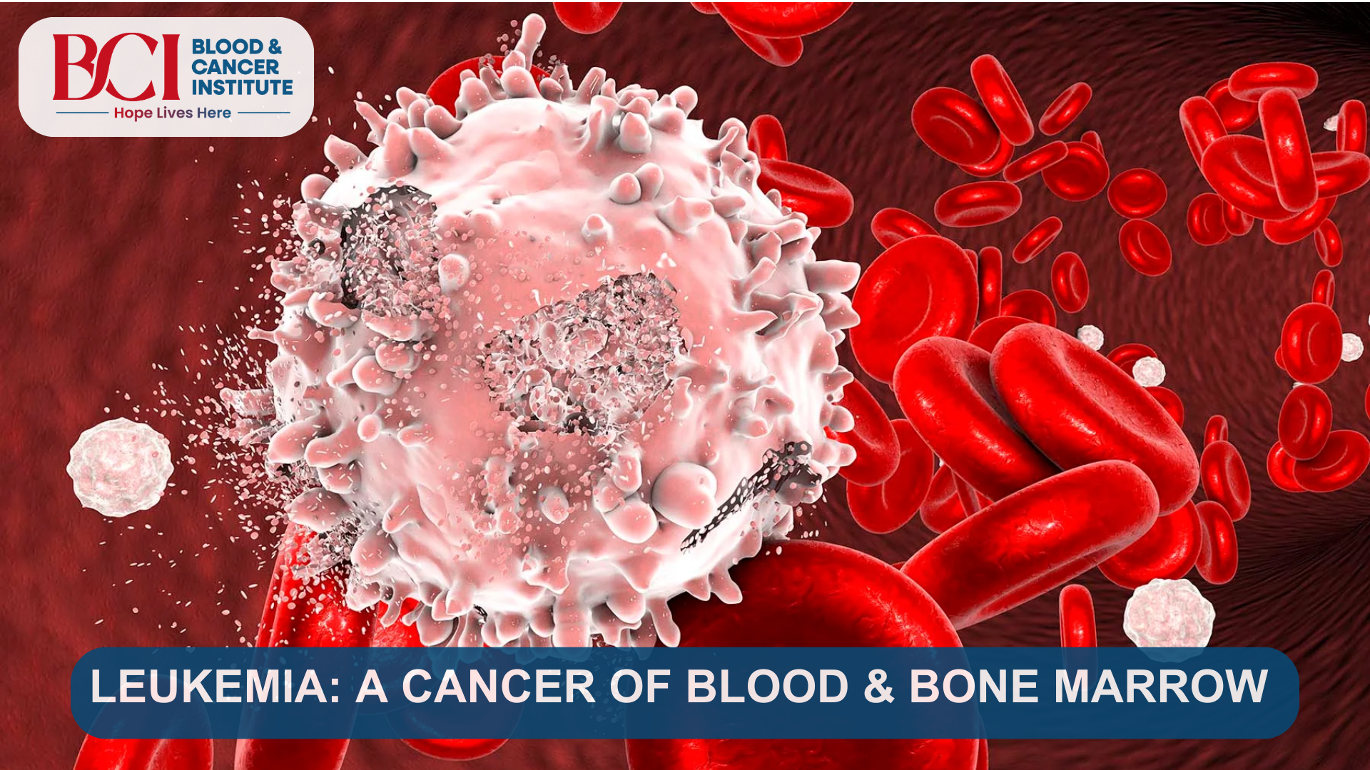 Blood Cancer Specialist in Surat