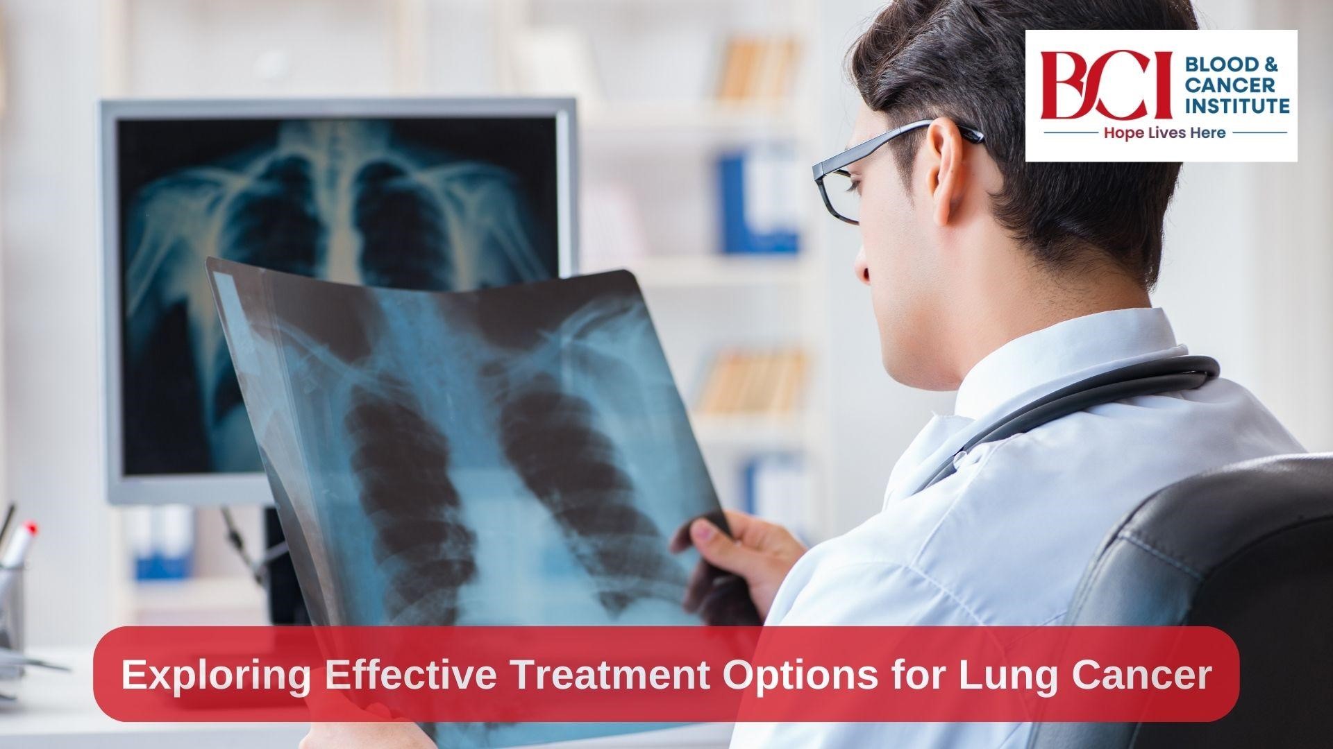 Treatment Options for Lung Cancer