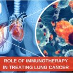 lung cancer specialists in Surat