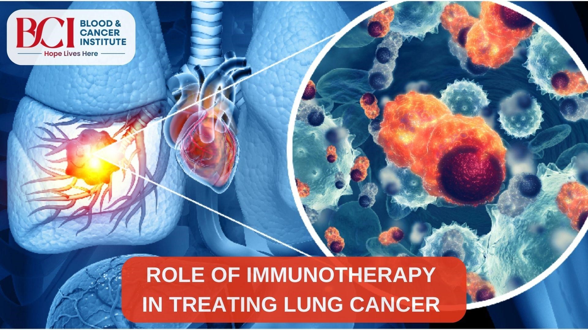 lung cancer specialists in Surat