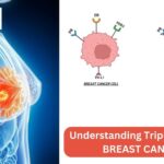 Understanding-Triple-Negative-Breast-Cancer-150x150.jpg