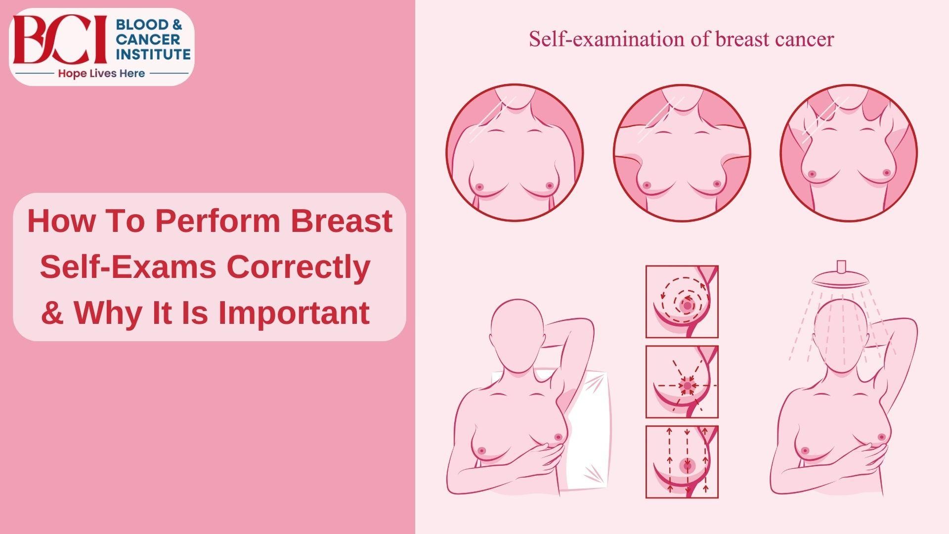 Breast Cancer Specialist In Surat