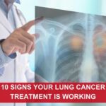 lung cancer specialists in Surat